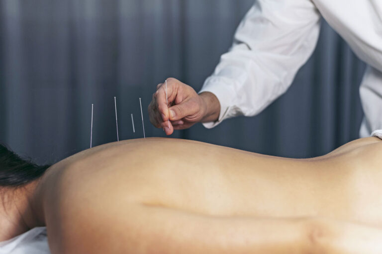 Hombre practicando un tratamiento de Puncion Seca en el centro de fisioterapia de Crisalud